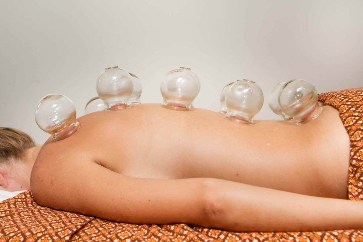 One of the hotel guests at Kamalaya Koh Samui during a cupping treatment